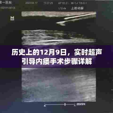 实时超声引导下内瘘手术步骤详解,历史视角下的12月9日