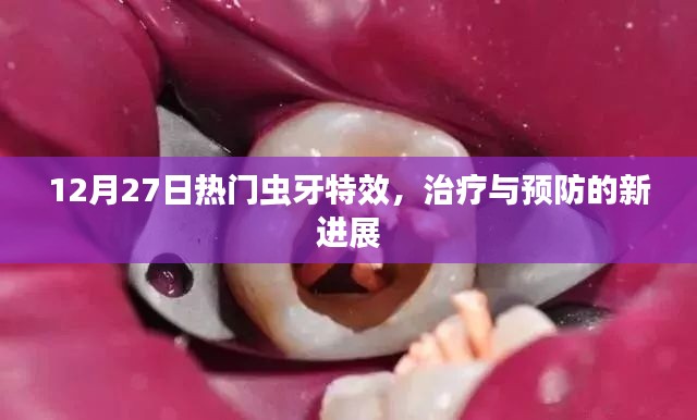 12月热门虫牙特效,治疗与预防最新进展